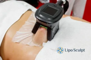 Cryolipolysis Helping You Getting that Perfect Summer Body 3 Cryolipolysis Bicester can give you the best summer body - contact us today!